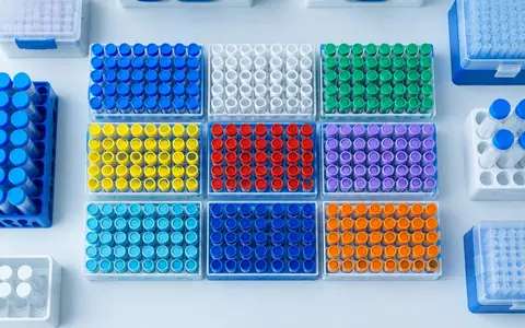 Laboratory sample racks sorted into colour-coded groups